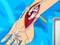 Spil Arm surgery 2