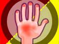 Spil Hands Attack