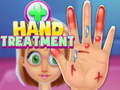 Spil Hand Treatment