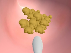 Spil Earwax Clinic